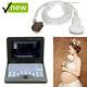 Portable Laptop Digital Ultrasound Scanner, Pregnancy, Abdominal Probe Us Seller