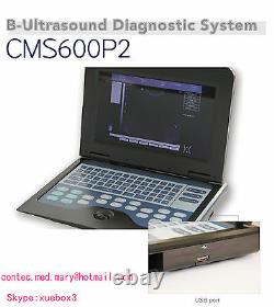 Portable laptop Machine Digital Ultrasound scanner, Convex probe 3.5MHZ US Seller
