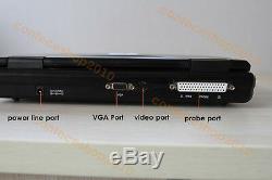 Portable laptop Machine digital ultrasound scanner+7.5M linear Probe, CE