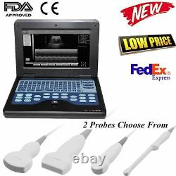 Portable laptop machine Digital Ultrasound scanner 2 probes optional, USA FedEx