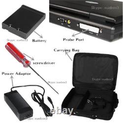 Portable laptop machine Digital Ultrasound scanner with Convex probe USA Seller