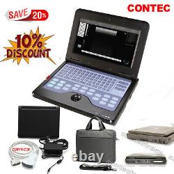 Promotion Digital ultrasound scanner Portable laptop machine, 3.5Mhz convex probe