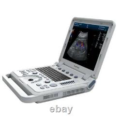 Pseudo-Color ultrasound scanner Laptop horse dog pregnancy vet ultrasound, Probes