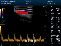 Pseudo-Color ultrasound scanner Laptop horse dog pregnancy vet ultrasound, Probes