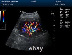 Pseudo-Color ultrasound scanner Laptop horse dog pregnancy vet ultrasound, Probes