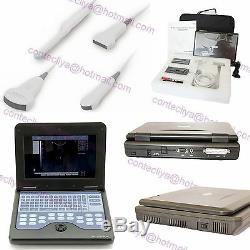 US CE Full Digital Ultrasound Scanner Diagnostic machine High resolution+4 Probe