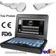 Us Fedex, Portable Laptop Machine Digital Ultrasound Scanner, Convex+ Linear Probe
