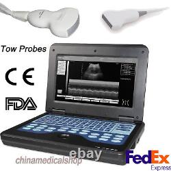 US Fedex, Portable laptop machine Digital Ultrasound scanner, convex+ linear probe