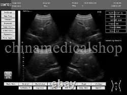 US Fedex, Portable laptop machine Digital Ultrasound scanner, convex+ linear probe