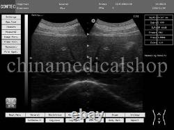 US Fedex, Portable laptop machine Digital Ultrasound scanner, convex+ linear probe