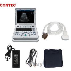 US Portable Ultrasonic Scanner Diagnostic Laptop Machine Convex Probe PW Doppler