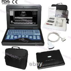 US Sell New Portable Laptop Ultrasound Scanner Machine Digital Convex For Human