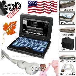 US Seller CONTEC Digital Laptop Ultrasound Scanner Machine Convex probe Human CE