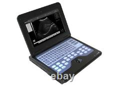 US Seller CONTEC Digital Laptop Ultrasound Scanner Machine Convex probe Human CE