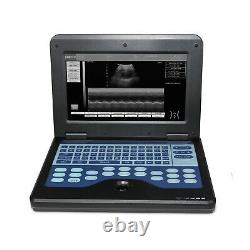 US Seller CONTEC Digital Laptop Ultrasound Scanner Machine Convex probe Human CE