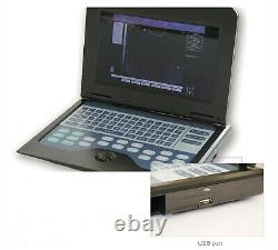 US Seller CONTEC Digital Laptop Ultrasound Scanner Machine Convex probe Human CE