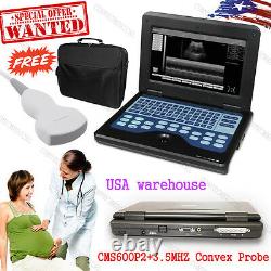 US Seller Digital Ultrasound Scanner Portable Laptop Machine, 3.5MHZ Convex Probe