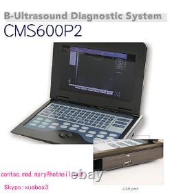 US seller Digital Ultrasound Scanner Laptop Machine with CONVEX+Linear 2 Probes