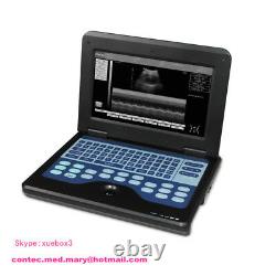 USA CE Portable Notebook Laptop Ultrasound machine Scanner system+3.5mhz Convex