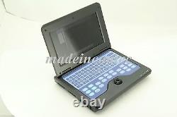 USA CONTEC Digital Laptop Ultrasound Scanner Medical System +Abdominal Probe FDA