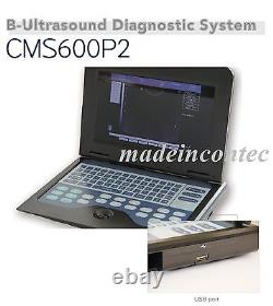 USA CONTEC Digital Laptop Ultrasound Scanner Medical System +Abdominal Probe FDA