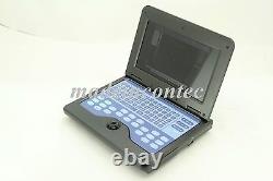 USA CONTEC Digital Laptop Ultrasound Scanner Medical System +Abdominal Probe FDA