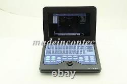 USA CONTEC Digital Laptop Ultrasound Scanner Medical System +Abdominal Probe FDA