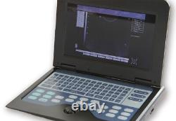 USA Digital Ultrasound Scanner Portable Laptop Ultrasound Machine+Convex Probe