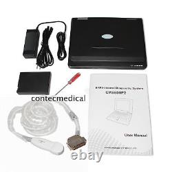 USA Portable Digital Ultrasound Scanner Laptop Machine+5.0MHZ Mirco-Convex Probe