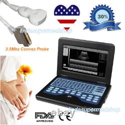 USA Portable Laptop Machine Digital Ultrasound Scanner, 3.5MHz Convex probe CONTE