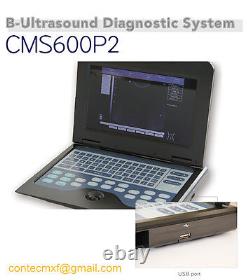 USA Portable laptop machine Digital Ultrasound scanner, Linear+Cardiac 2 Probes