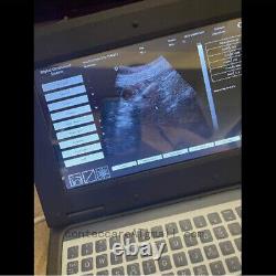 USA VET Laptop Ultrasound Scanner Notebook Digital Machine, 3.5M Convex Probe, FDA