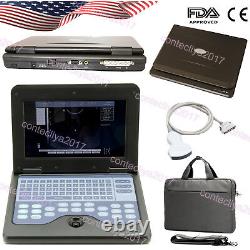 Ultrasound Scanner Digital laptop Machine, 3.5 convex probe, abdomen CMS600P2 USA