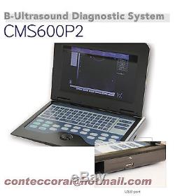 Us seller, Full Digital Portable Laptop B-ultrasound Scanner Machine+2 Probes