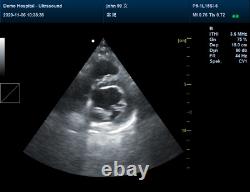 VET Veterinary Color Ultrasound Scanner Digital Animal Diagnostic 7.5Mhz Rectal