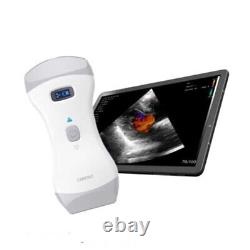 Vet Handheld Color Doppler Ultrasound Scanner Machine 2 Probes Wifi Wireless, USA