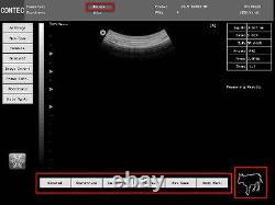 Vet Veterinary Digital Laptop/Notebook B-Ultrasound Scanner rectal &convex probe