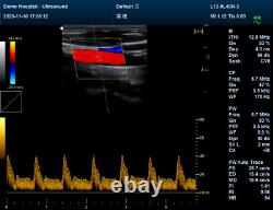 Veterinary Color Ultrasound Scanner with 7.5 Mhz rectal Probes for Bovine, equine