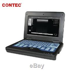 Veterinary Ultrasound Scanner Portable Laptop Machine, 7.5 Rectal, horse/CowithSheep