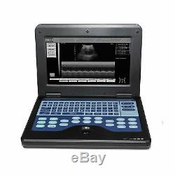 Veterinary Ultrasound Scanner Portable Laptop Machine, Equine&Bovine Use USA Vet