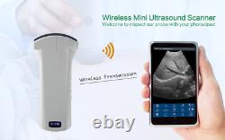 Wifi Wireless Color Convex Ultrasound Electronic Scanner 192 Elements 3.5MHz/5MH
