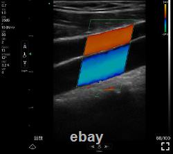 Wireless Color Doppler Ultrasound Scanner Dual Head Phased Cardiac Linear Probe