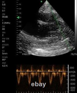 Wireless Color Doppler Ultrasound Scanner Dual Head Phased Cardiac Linear Probe