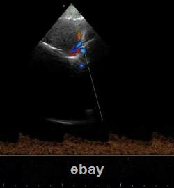 Wireless Color Doppler Ultrasound Scanner Dual Head Phased Cardiac Linear Probe