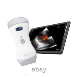 Wireless Color Doppler Ultrasound Scanner Wifi Machine Android Portable 2 Probes