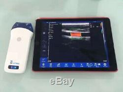 Wireless WiFi Portable Color Linear Ultrasound Scanner 7.5/10 MHZ Harmonic FDA